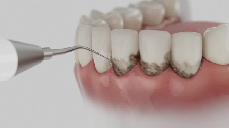 Reliable Tooth Extraction contractor in Wayne County County, TN by Dentist Open Now
